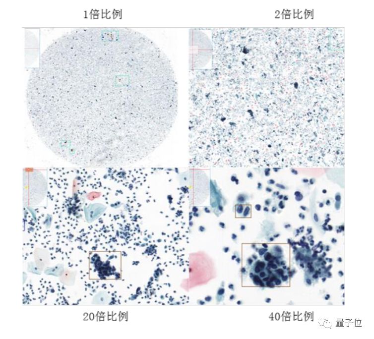 医疗人工智能_诊断人工医疗智能技术_人工智能医疗诊断